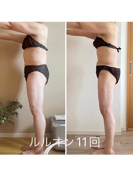 ヨサパーク ツムギ(YOSA PARK)の写真/〈短期集中でダイエットしたい方は当店にお任せ〉結果重視×短期で集中で身体の変化を実感頂けます!