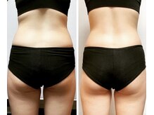 ザ ボディメイク(THE BODY MAKE)/お尻シェイプでくびれができる！