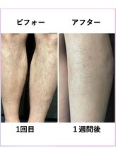 メンズ シンバ(SIMBA)/☆ ビフォーアフター ☆