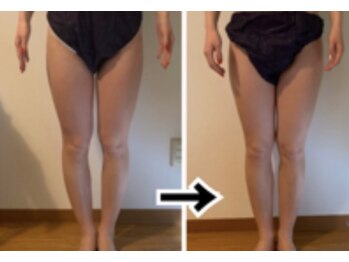 プリンセスモモ 佐世保白岳店(Princes Momo)/ビフォーアフター