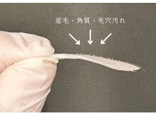サウスポート 南堀江(South Port)の雰囲気（【フェイシャルワックス脱毛】フェイシャル脱毛で化粧ノリUP♪）