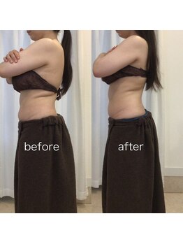 ジョワイユ(Joyeux)/腸の位置でお腹は変わる