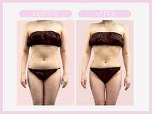 スリムライン 仙台店(The Slim Line)/before→after