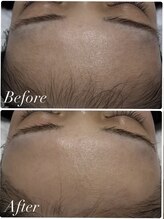 ルゼル(lezele)/フェイスワックス＆美容脱毛