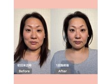 フェルナ(FERNA)の雰囲気（Before/Afterはフォトギャラリーをご覧ください。）
