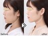 【小顔矯正+小顔リンパマッサージ】+【首肩矯正】50分　◇二重あご 集中！◇