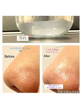 グレイティフル(Grateful)/イチゴ鼻・全顔ごっそり汚れ除去