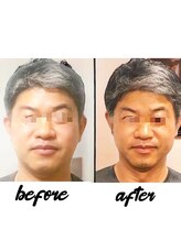 ラグラン銀座メディカルエステ 高輪ゲートウェイ店/男性の小顔+毛穴ケア