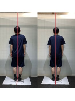 ラグ整体院(rag整体院)/姿勢改善40代　