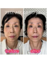 ハーボプラス(THE HEARBO plus)/目が開けやすい！