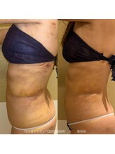 マドモアゼル 麻布十番/インディバ