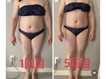 ティアラ(TIARA)/痩身　ウルトランスフォーマー2