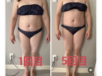 ティアラ(TIARA)/痩身 ウルトランスフォーマー2