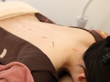 美鍼堂/東洋鍼灸