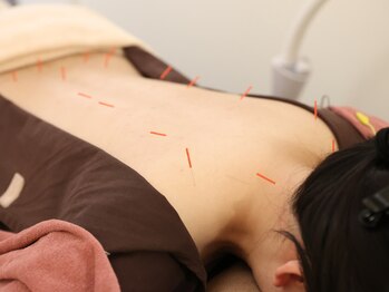 美鍼堂/東洋鍼灸