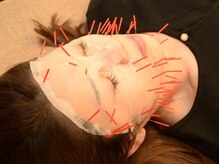 かんの鍼灸整骨院