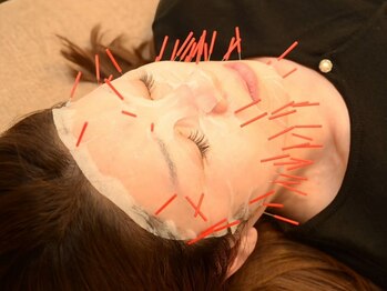 かんの鍼灸整骨院の写真/小顔×エイジングケアを実感【幹細胞パック×美容鍼×肩首・ヘッドマッサージ】本来のお顔を取り戻せる!　
