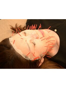 小顔になりたい