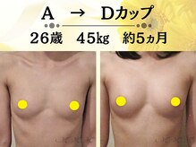 メディカルサロン エム エム エム 心斎橋本店(M.M.M)の雰囲気（ボリュームUP技術が豊富！寄せ集めるのではなく内側からバストUP）