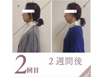 ラニ(Lani)/小顔美人整顔