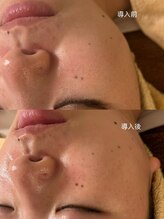 アンジュ/【レモンボトル】導入！