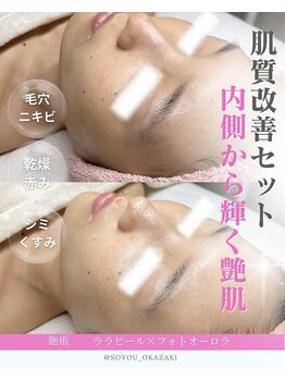 ソユ(SOYOU)/施術* &nbsp;&nbsp;&nbsp;ララピール×フォト