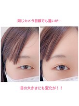 グラニーエム(Grnny.M)/瞼へのアプローチで変化する.