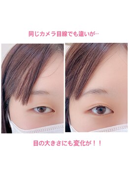 グラニーエム(Grnny.M)/瞼へのアプローチで変化する.