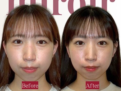 ミロワール(miroir)の写真