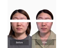 シャルム(CHARMEB)の雰囲気（効果を実感できる美容鍼サロン★小顔/美容鍼/天王寺）