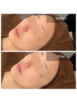 ビビ(VIVI)/ララピールでツヤ感アップ☆