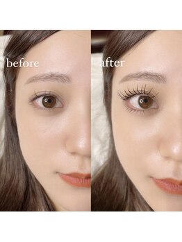 ノラ ギンザ(NORA GINZA)/before after