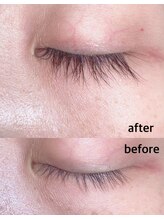 キュー(cue)/ラッシュアディクトの効果