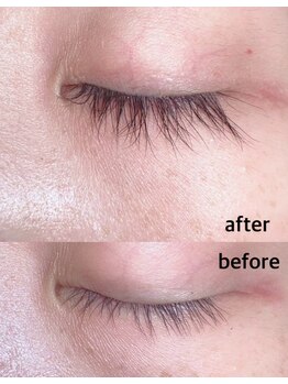 キュー(cue)/ラッシュアディクトの効果