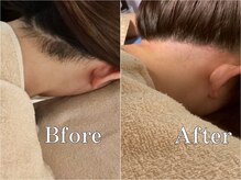 セドニー 代官山(CEDNEI)/【うなじWax脱毛】