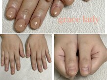 グレースレディ/見た目をその日で