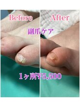 巻き爪補正店 八王子店/