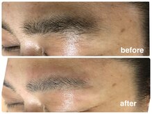 アップル マリー 江別/■糸脱毛（似合わせ眉毛脱毛）