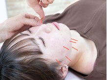 ツボバランス 大垣の雰囲気（「顔色が明るくなった」「むくみが取れた」と好評の美容鍼。）