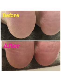 ロアルアナ(loa Luana)/角質ケア☆(単品¥4400)