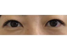 アイラッシュサロン ナチュレ 新河岸店(NATURE)/フラットラッシュ100本