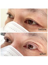 ヴィヴィアンジュ(viviange)/ラッシュリフト