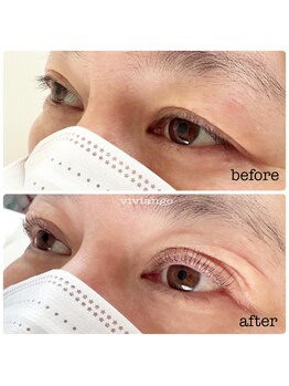 ヴィヴィアンジュ(viviange)/ラッシュリフト