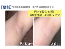 ピュアノア 三木店