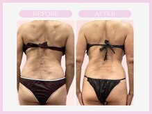 スリムライン 盛岡店(The Slim Line)/before→after