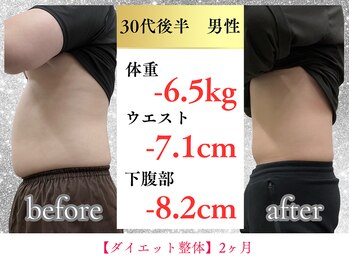 ボディメイク アールエフ サクラ接骨院(bodymake RF SAKURA接骨院)/30代　2ヶ月で下腹部ー8.2cm