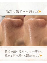 ミリアージュ(Miliage)/before / after