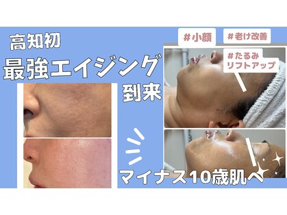 ミライ(Mirai)の写真