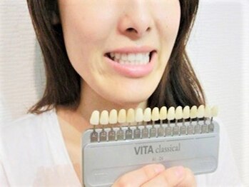 ホワイトニングサロン 熊本店/【ホワイトニング　STEP 1】