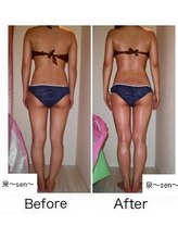 リコメンス(Recommence)/全身美容矯正